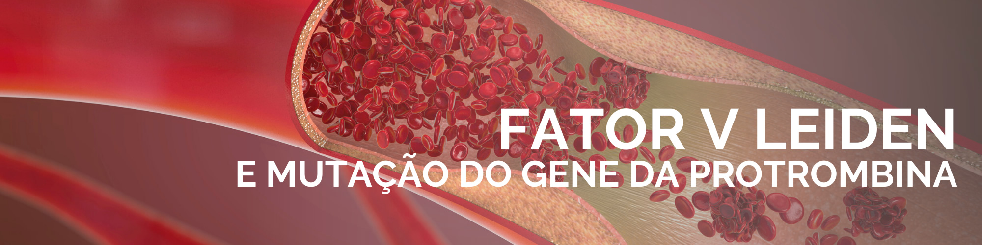 FATOR V LEIDEN E MUTAÇÃO DO GENE DA PROTROMBINA